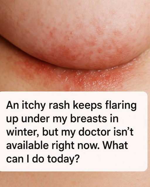 If you’re getting an itchy rash under your breasts in winter, it’s ...